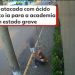 Júri popular vai decidir se acusados de atacar jovem com soda cáustica no Paraná cometeram tentativa de feminicídio